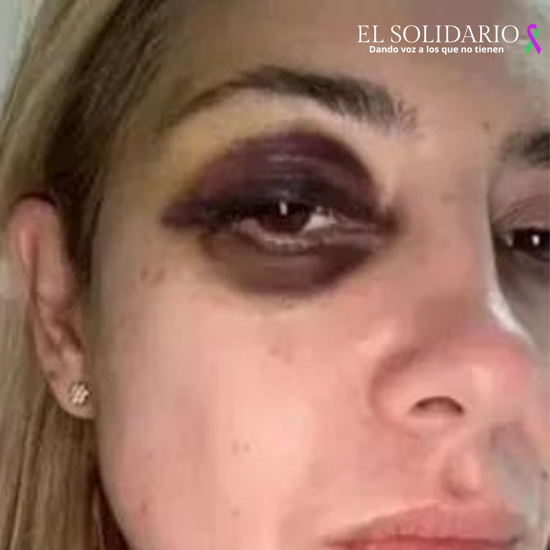 Fabiola Yáñez