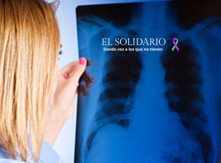 tumores primarios pueden modificar el microambiente pulmonar, facilitando la formación de metástasis en este órgano vital. 