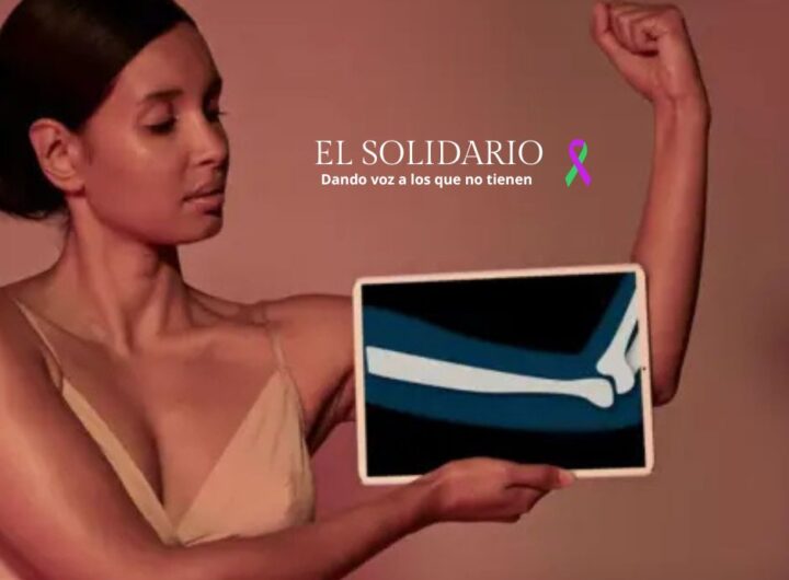 Cuidar tus huesos no es solo tomar calcio