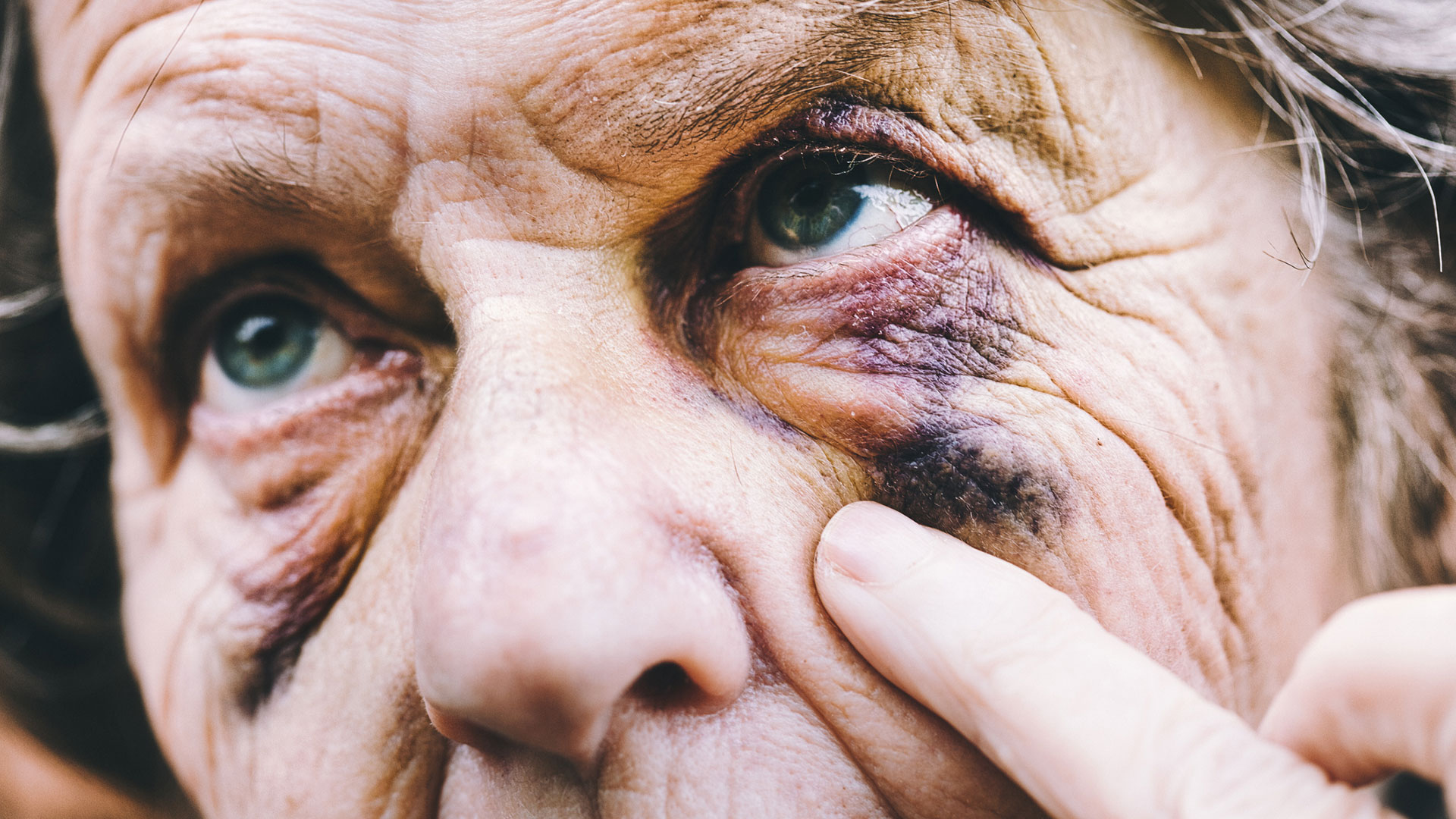 Día Mundial contra el Maltrato en la Vejez: cómo detectar y denunciar el abuso a los ancianos