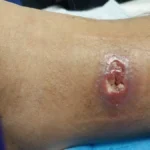 Fuente La Sexta