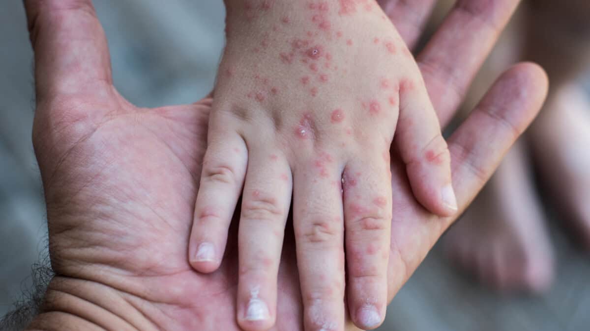 Sanidad pública: la razón por la que España protege mejor al enfermo que Estados Unidos