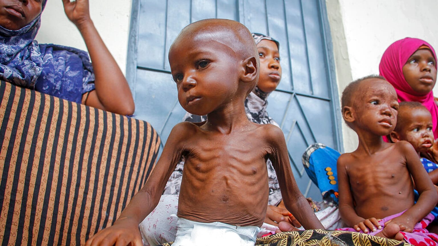 África concentra 309 millones de personas con hambre y se convierte en el epicentro mundial de la crisis alimentaria